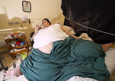 Muere el mexicano considerado más gordo del mundo