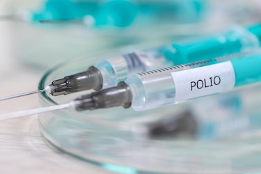 La polio está al acecho por la baja tasa vacunal; Minsa exhorta vacunar a los niños