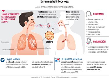 Pandemia de la Covid-19 dificulta  la lucha contra la tuberculosis 