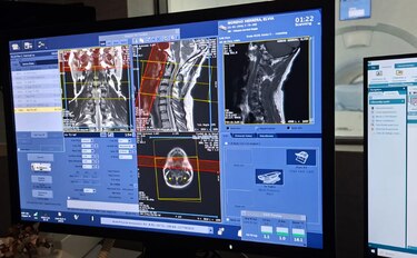 Pacientes en lista de espera: 7,311 estudios de resonancia sin realizar en la CSS