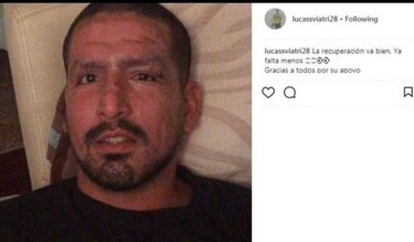 Futbolistas resultan quemados con pirotecnia