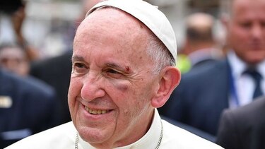 El papa Francisco se golpea en la mejilla por un frenazo del papamóvil