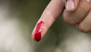 Las heridas se curan más lento si ocurren de noche