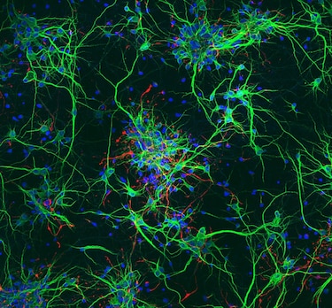 Crean un biomaterial con interés potencial para recuperar los daños en la médula espinal