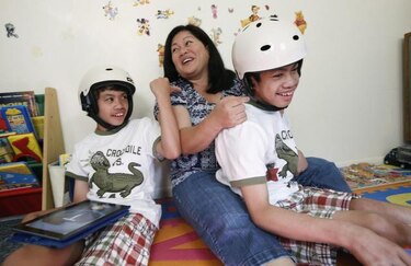 Diez años después, siameses tienen vidas separadas