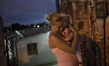 Una de cada 100 mujeres infectadas de  zika puede tener un bebé con microcefalia