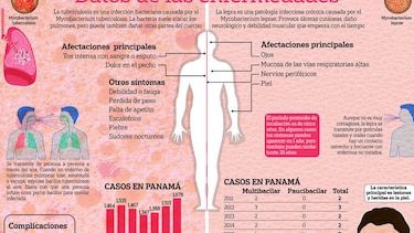 Lepra y tuberculosis, aún activas