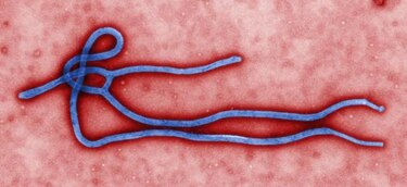 Científicos tailandeses hallan un anticuerpo contra el ébola aún en prueba