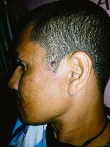 Docente huelguista recibe balinazo