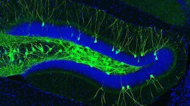 Memoria perdida por Alzheimer puede recuperarse, según estudio