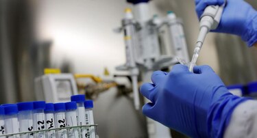 Una mujer de 28 años es el primer caso de viruela símica en El Salvador